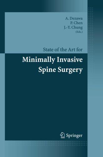 【预订】State of the Art for Minimally Invas...