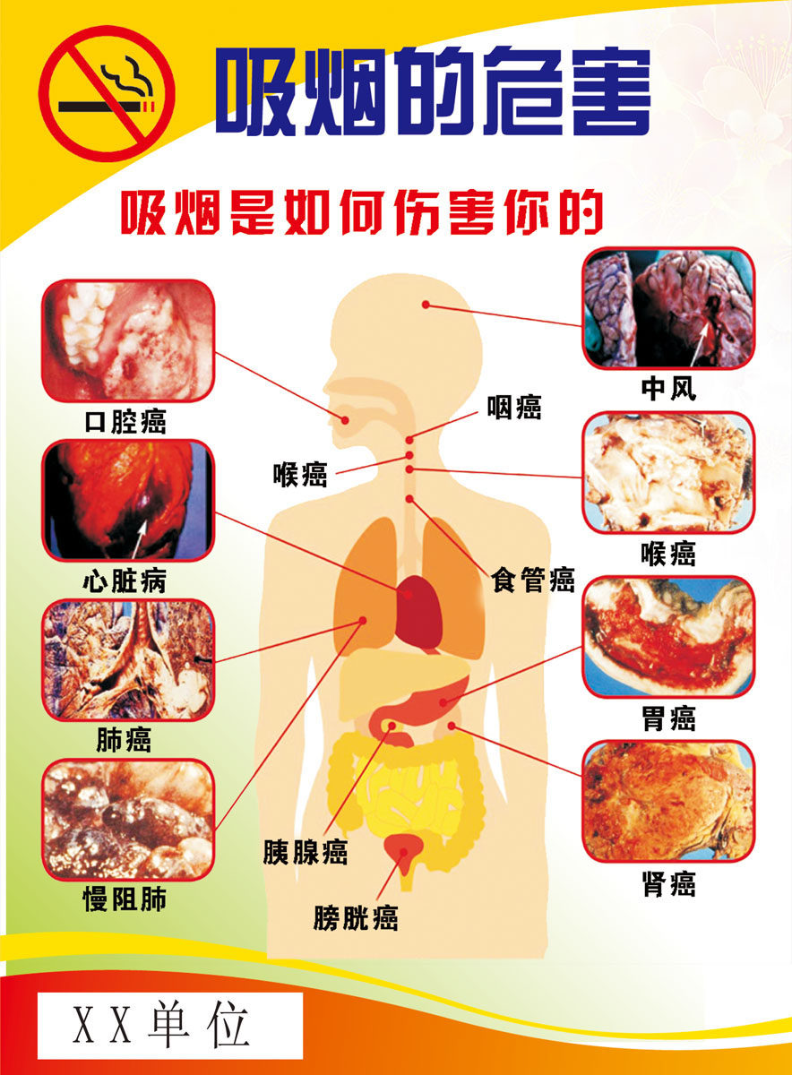 737海报印制展板写真喷绘贴纸382吸烟的危害挂图