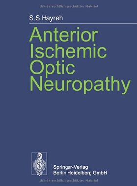 【预订】Anterior Ischemic Optic Neuropathy