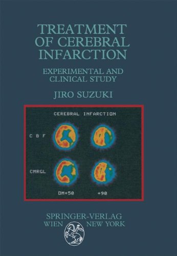 cerebral infarction,cerebral 【预订】treatment of cerebral infarction: ex.