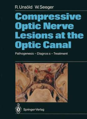 【预订】Compressive Optic Nerve Lesions at t...