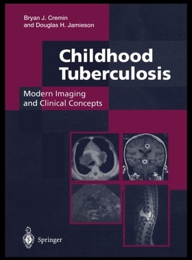 【预售】Childhood Tuberculosis: Modern Imaging and Clinic