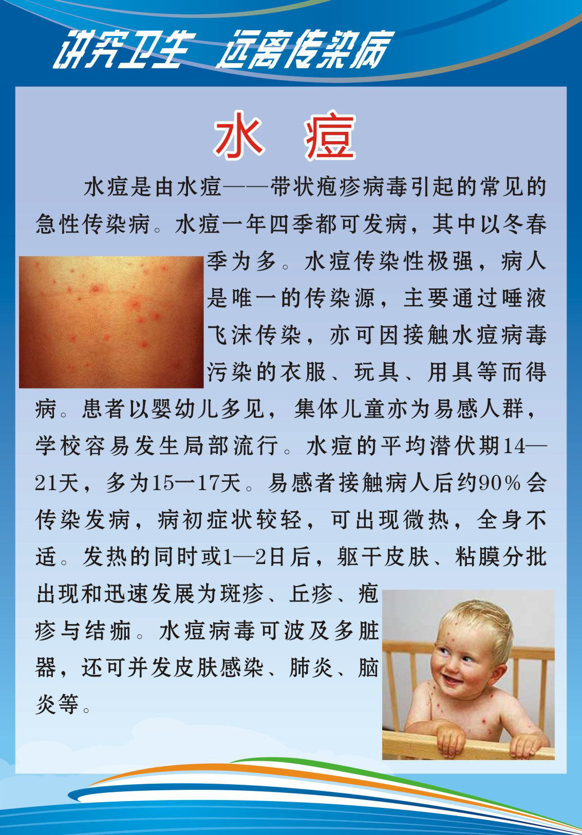 728海报印制展板写真喷绘贴纸627校健康知识3水痘