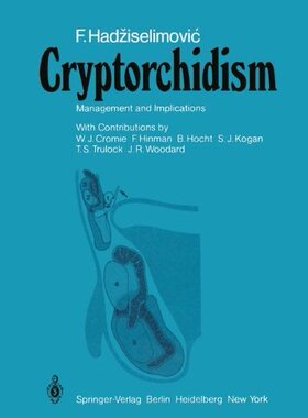 【预订】Cryptorchidism: Management and Impli...