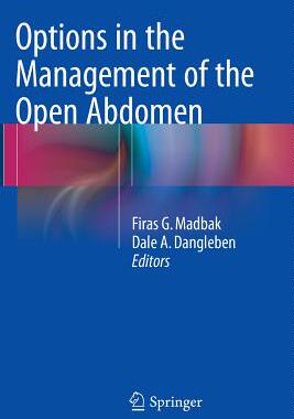 【预订】Options in the Management of the Ope...