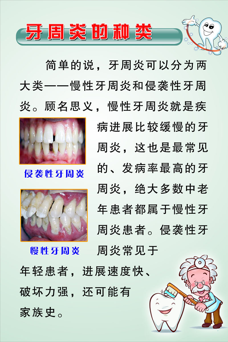 735海报印制展板写真喷绘贴纸838牙周炎的种类知识