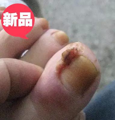 指头生蛇  头 疮 脚指头生 蛇头 疮 生蜈蚣 肚 莲藕 节 满口蛇