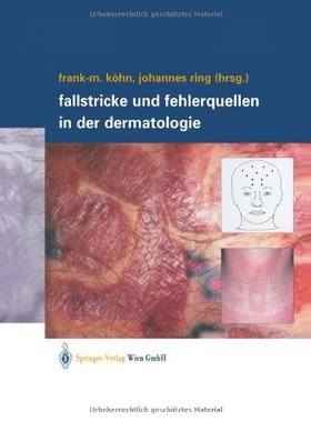 【预订】Fallstricke Und Fehlerquellen in Der...