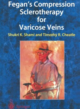 【预订】Fegan S Compression Sclerotherapy fo...