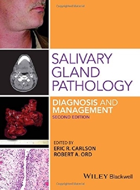 【预订】Salivary Gland Pathology