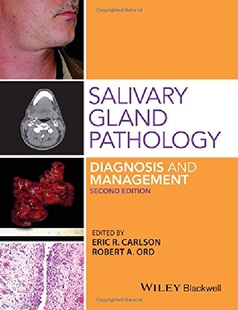 【预订】Salivary Gland Pathology