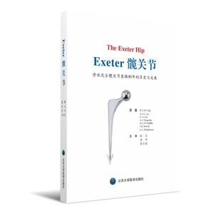 EXETER髋关节