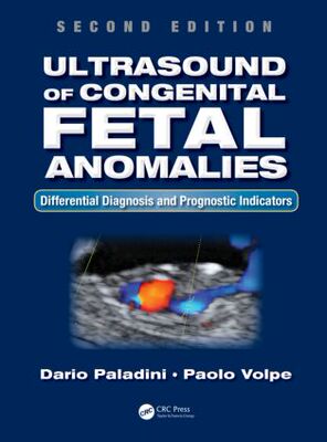 【预订】Ultrasound of Congenital Fetal Anomalies