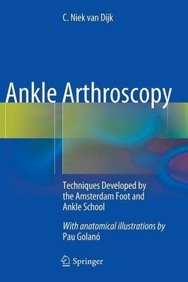 【预订】Ankle Arthroscopy