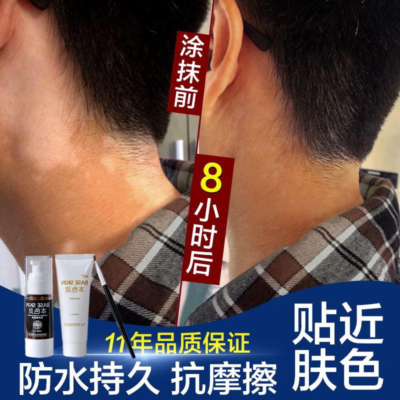 遮盖白色胎记疤痕假皮肤隐形贴遮瑕膏白斑液强力防水持久摩擦白疤在类目 彩妆/香水/美妆工具, 遮瑕中 - 来自Buy2taobao.com提供专业的淘宝代购服务