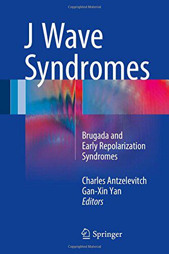 【预订】J Wave Syndromes