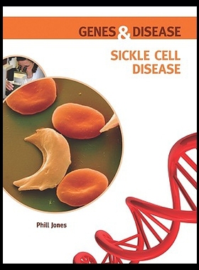 【预售】Sickle Cell Disease