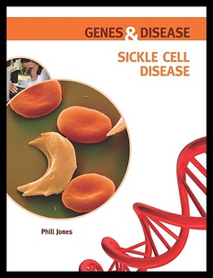 【预售】Sickle Cell Disease