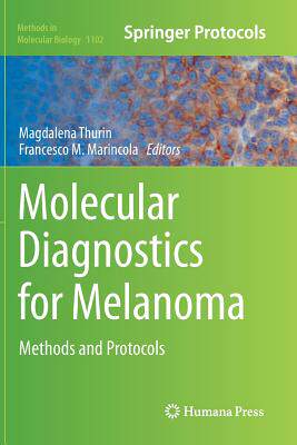 【预订】Molecular Diagnostics for Melanoma: ...