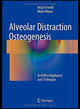 【预售】Alveolar Distraction Osteogenesis: Arc