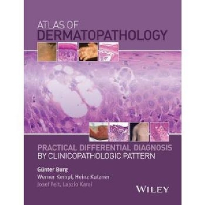 【预订】Atlas of Dermatopathology - Practica...