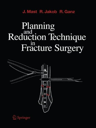 【预订】Planning and Reduction Technique in ...