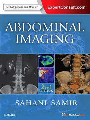 【预订】Abdominal Imaging