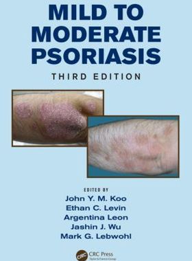 【预售】Mild to Moderate Psoriasis, Third Edition