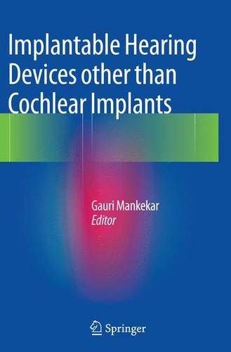 美国库房发货,通常付款后5-8周到货！