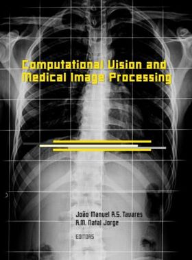 【预售】Computational Vision and Medical Image Processi