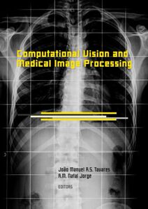 【预售】Computational Vision and Medical Image Processi