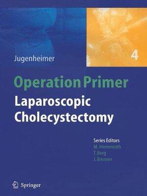 【预订】Laparoscopic Cholecystectomy