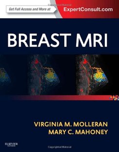 MRI Breast 预售