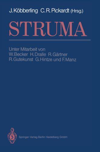 【预订】Struma