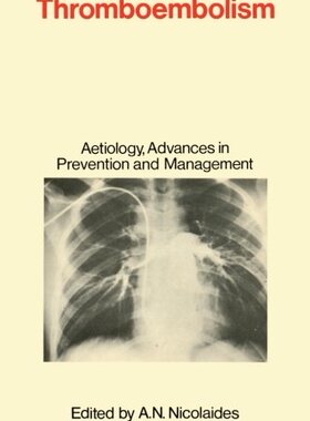 【预订】Thromboembolism: Aetiology, Advances...