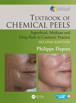 【预订】Textbook of Chemical Peels, Second Edition