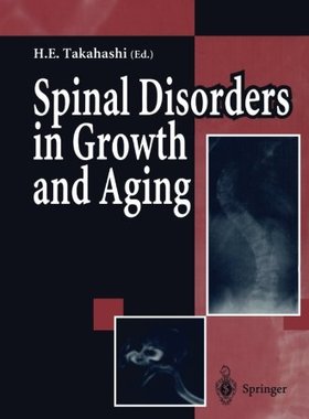 【预订】Spinal Disorders in Growth and Aging