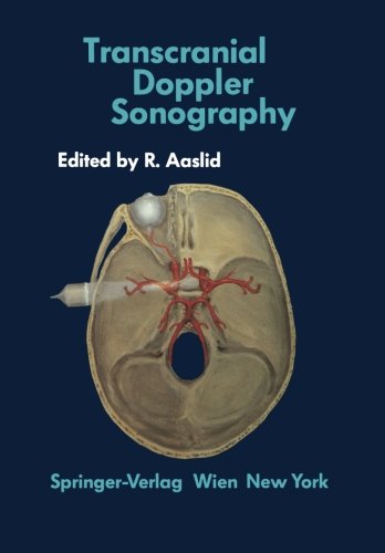 【预订】Transcranial Doppler Sonography 书籍/杂志/报纸 科普读物/自然科学/技术类原版书 原图主图