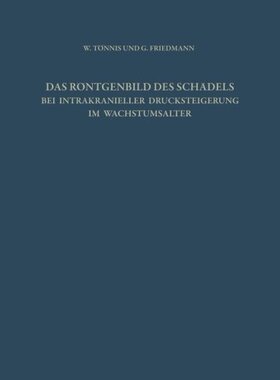 【预订】Das Rontgenbild Des Schadels Bei Int...