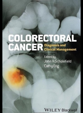 【预售】Colorectal Cancer: Diagnosis and Clinical Managem