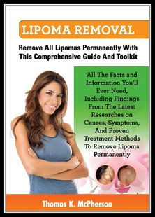 【预售】Lipoma Removal, Lipoma Removal Guide. Discover Al