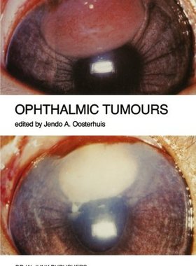 【预订】Ophthalmic Tumours: Including Lectur...
