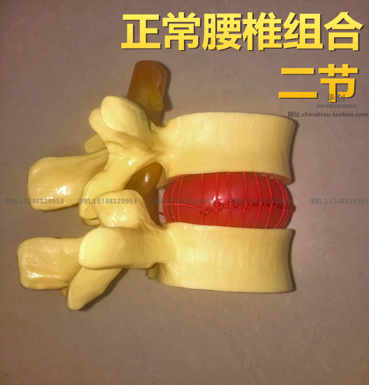 116正品医学腰椎正常组合模型椎间盘突出骨科教学骨骼病变模型