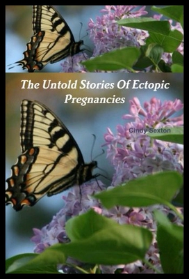 【预售】The Untold Stories of Ectopic Pregnancies