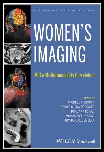 【预售】Women's Imaging: MRI with Multimodalit