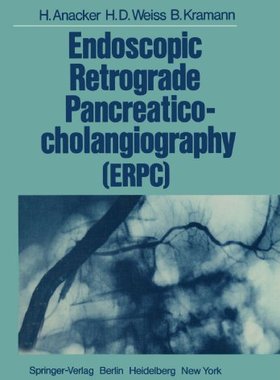 【预订】Endoscopic Retrograde Pancreaticocho...