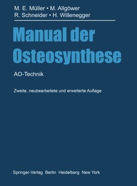 【预订】Manual Der Osteosynthese: Ao-Technik