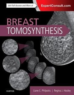 Tomosynthesis Breast 预订