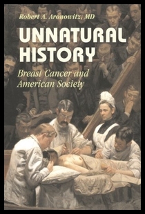 History Unnatural Breast Cancer and 预售