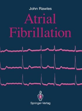 【预售】Atrial Fibrillation